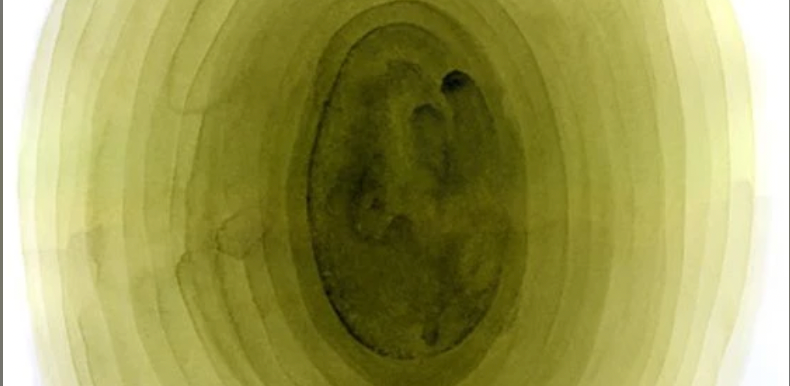 IVF Cost in Bangalore: Pricing, Factors, and What to Expect