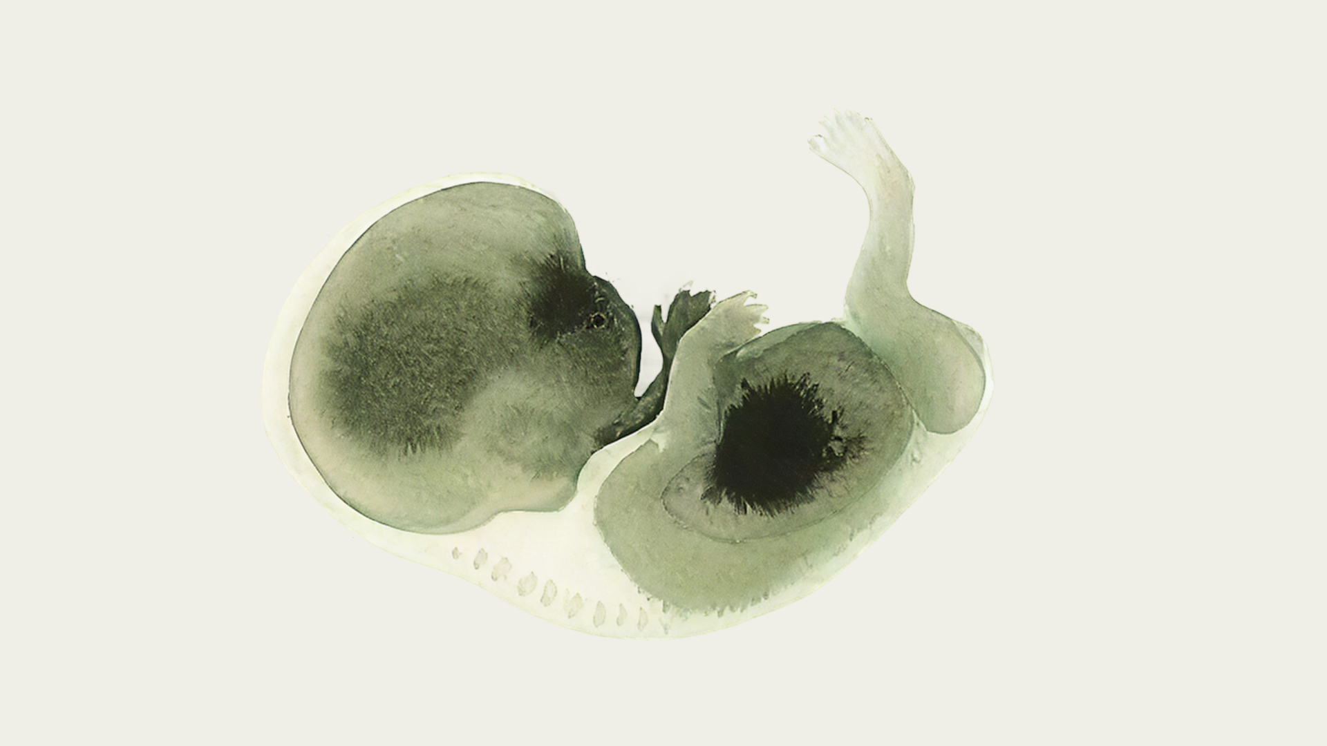 IVF Success Rates by Age: What You Need to Know in 2025