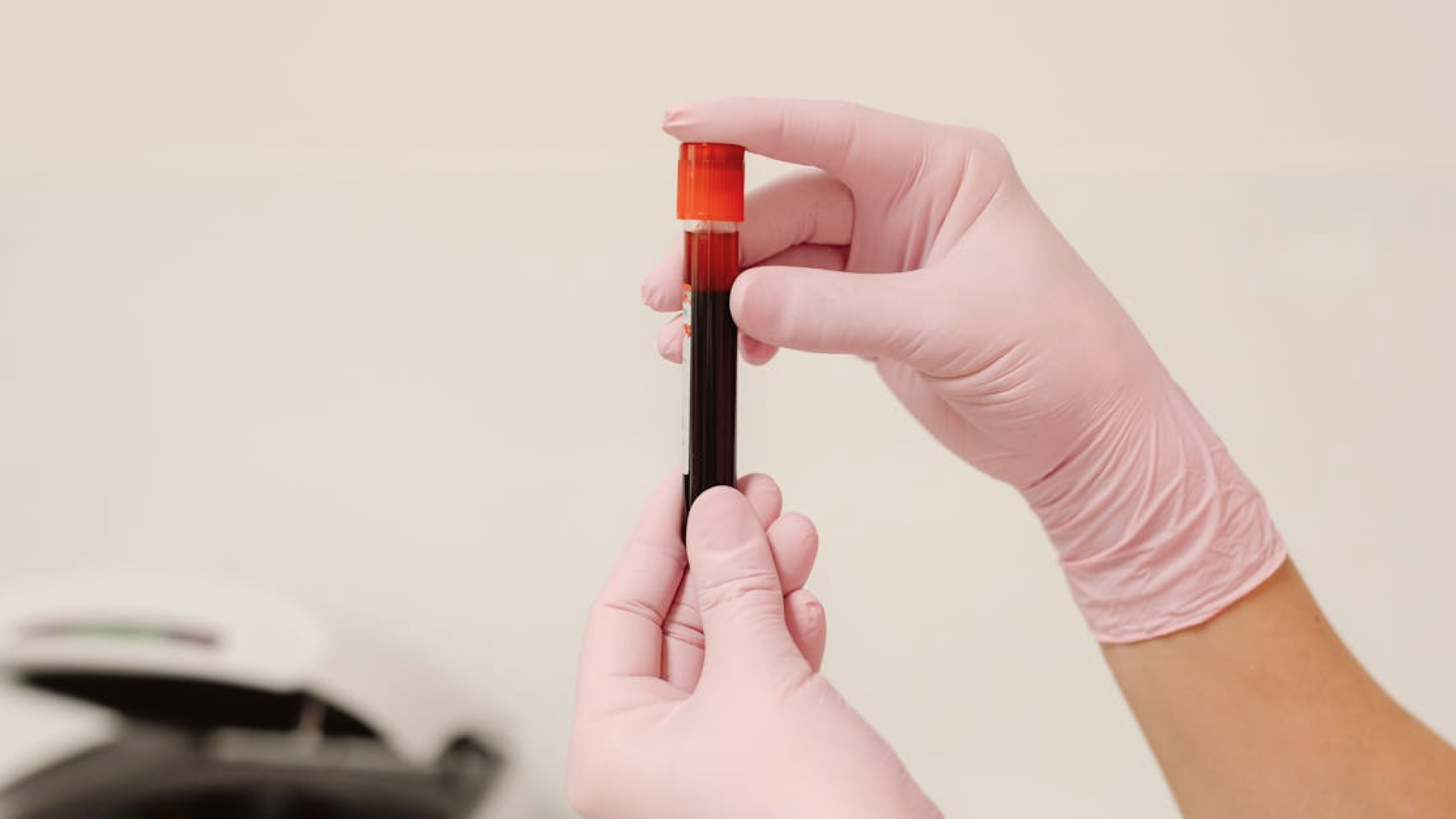 Day 2 hormone test explained (and why timing matters so much)