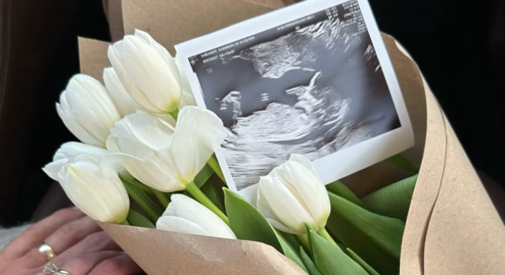 How to Prepare for IUI Treatment? A Step-by-Step Guide