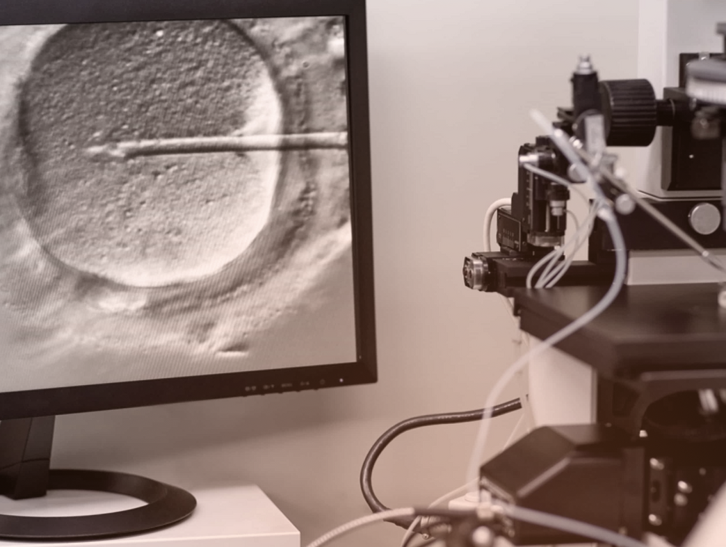 HSG Test: Everything to Know Before and After Your Procedure